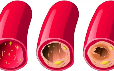 Foods that Lower Cholesterol